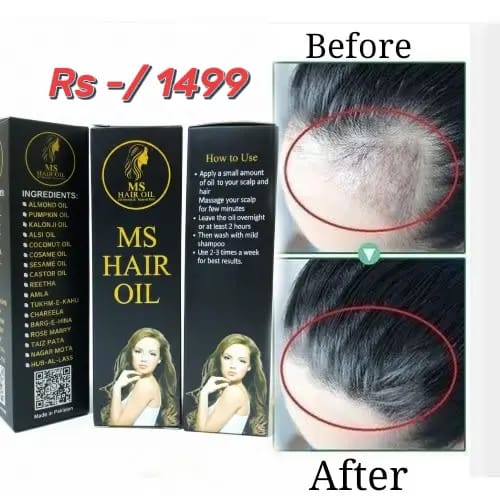 MS HAIR OIL